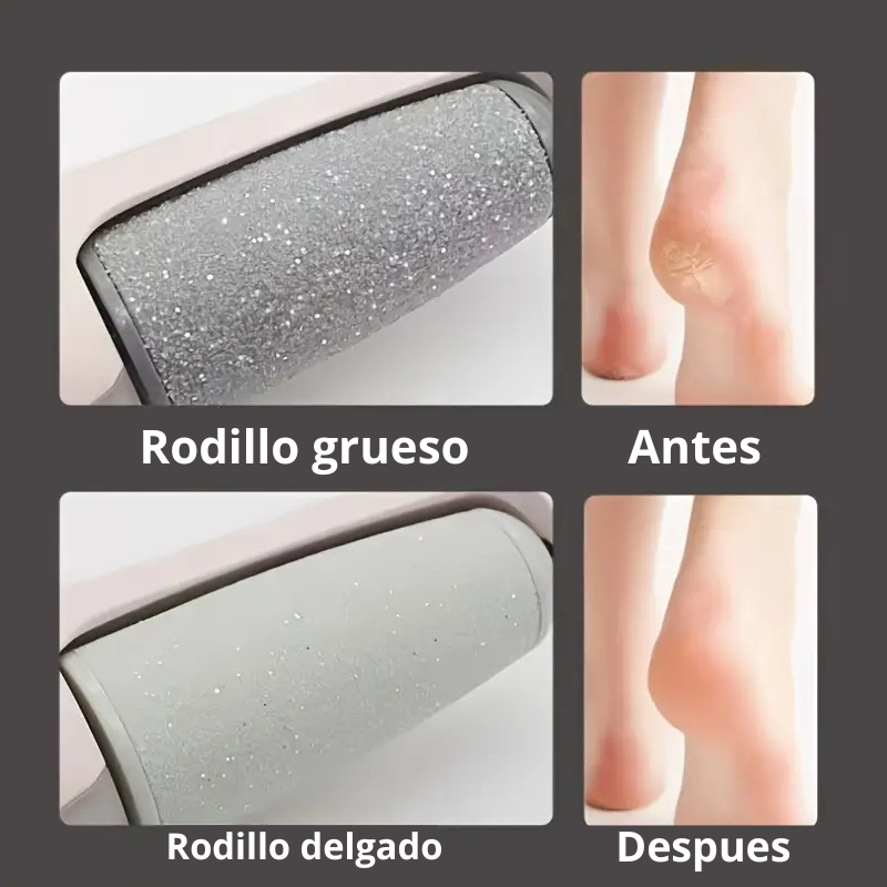 Remueve callos electrico - Pediluz